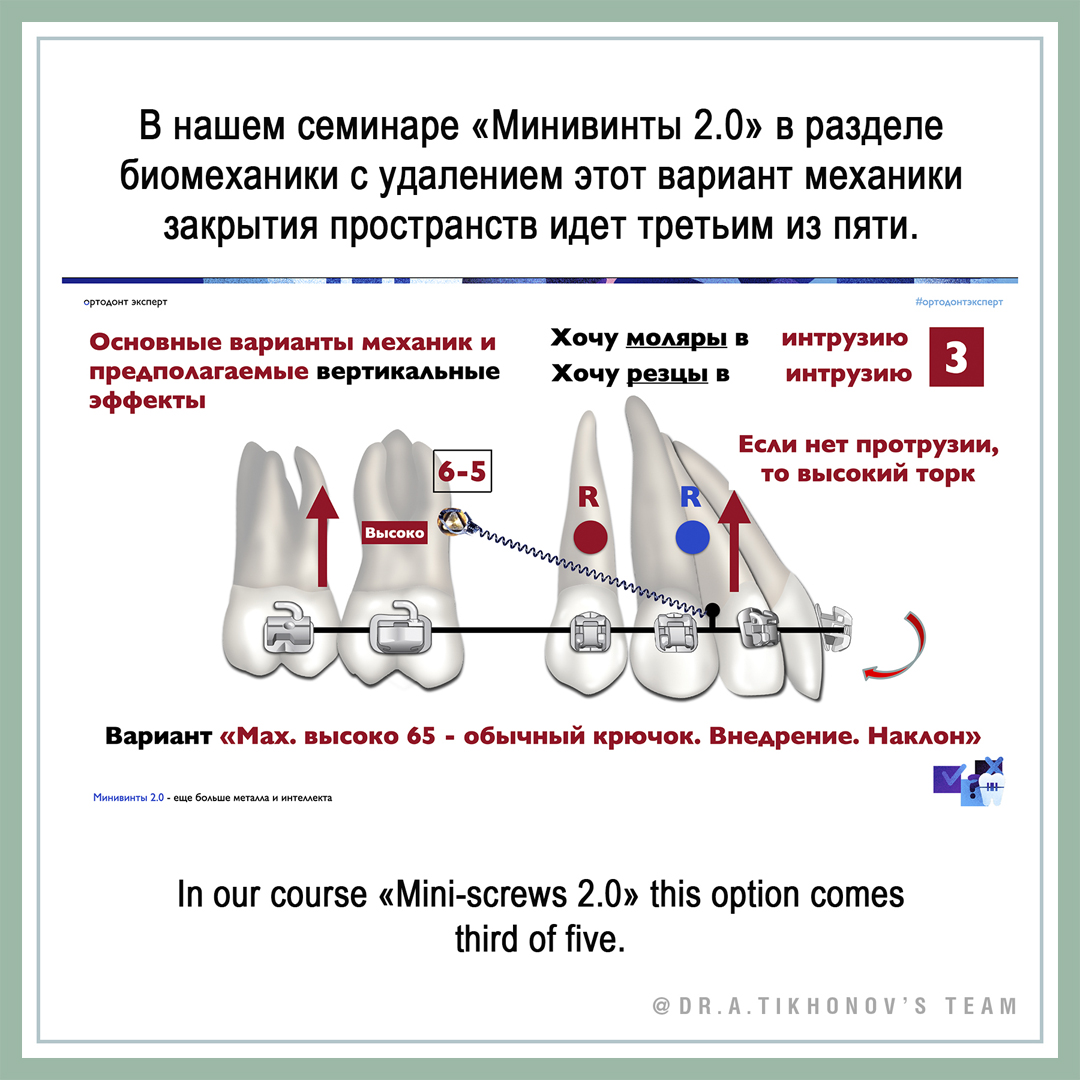 Компенсация хирургического скелетного 2 класса - ответы. - интересно об  ортодонтии, имплантации и протезировании зубов